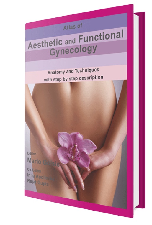 Aesthetic gyanecology book 